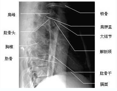备考经验-2014年实践技能医师医学影像学:肱骨