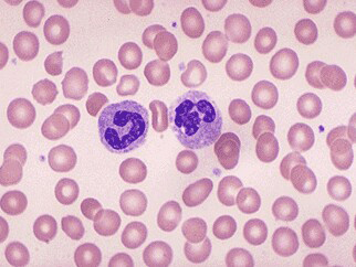 2015临床医师:血液系统1-文都公务员考试网